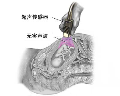 孕期必做的超声检查法(图)