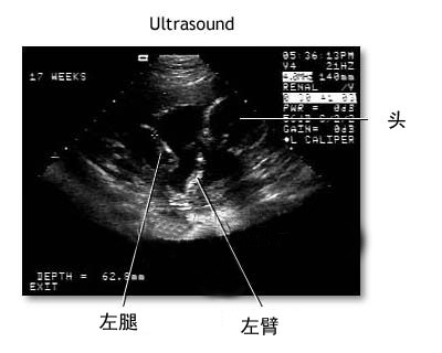 孕期必做的检查法(图)